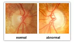 Opto-Mization optometry clinic interior showcasing vision therapy equipment and patient consultations.