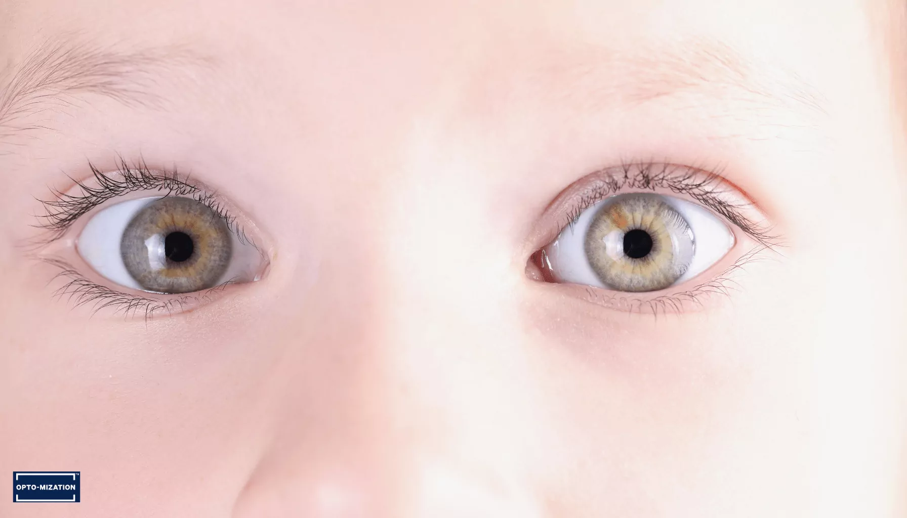 Understanding Lazy Eye (Amblyopia): Beyond Patching and Into Vision Therapy