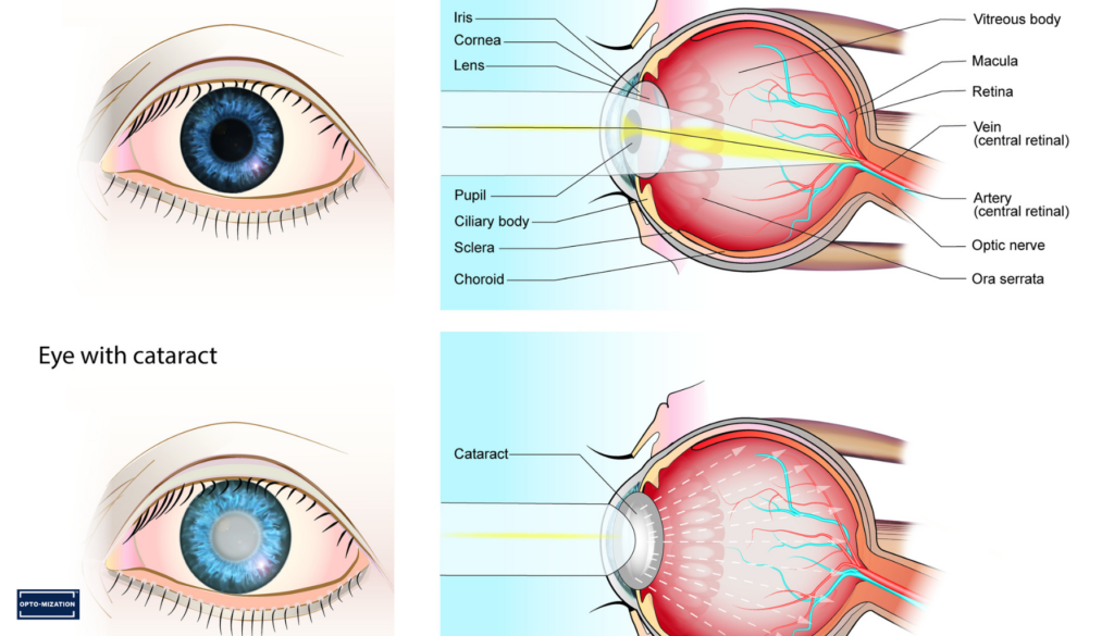 Looking for Eye Specialists in Victoria BC? Understanding Functional and Comprehensive Vision Care
